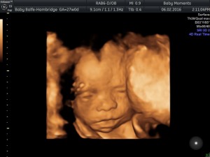 ultrasound scan
